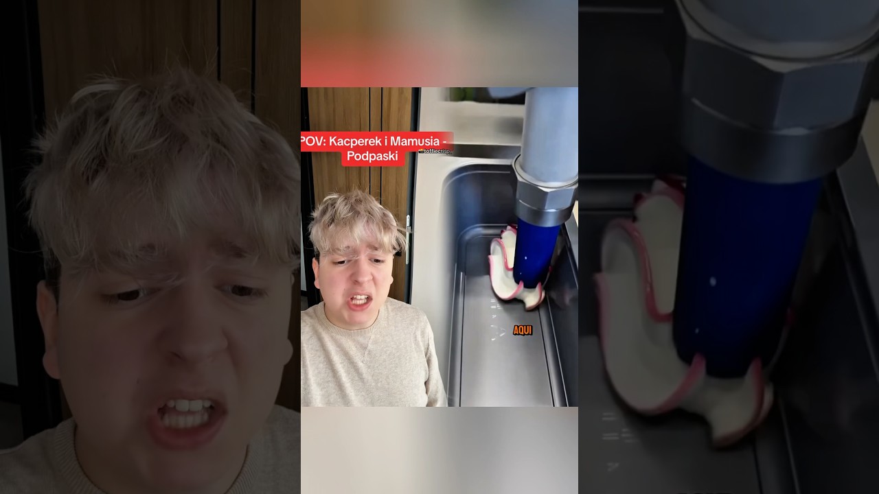 Czy jego to boli? XD 