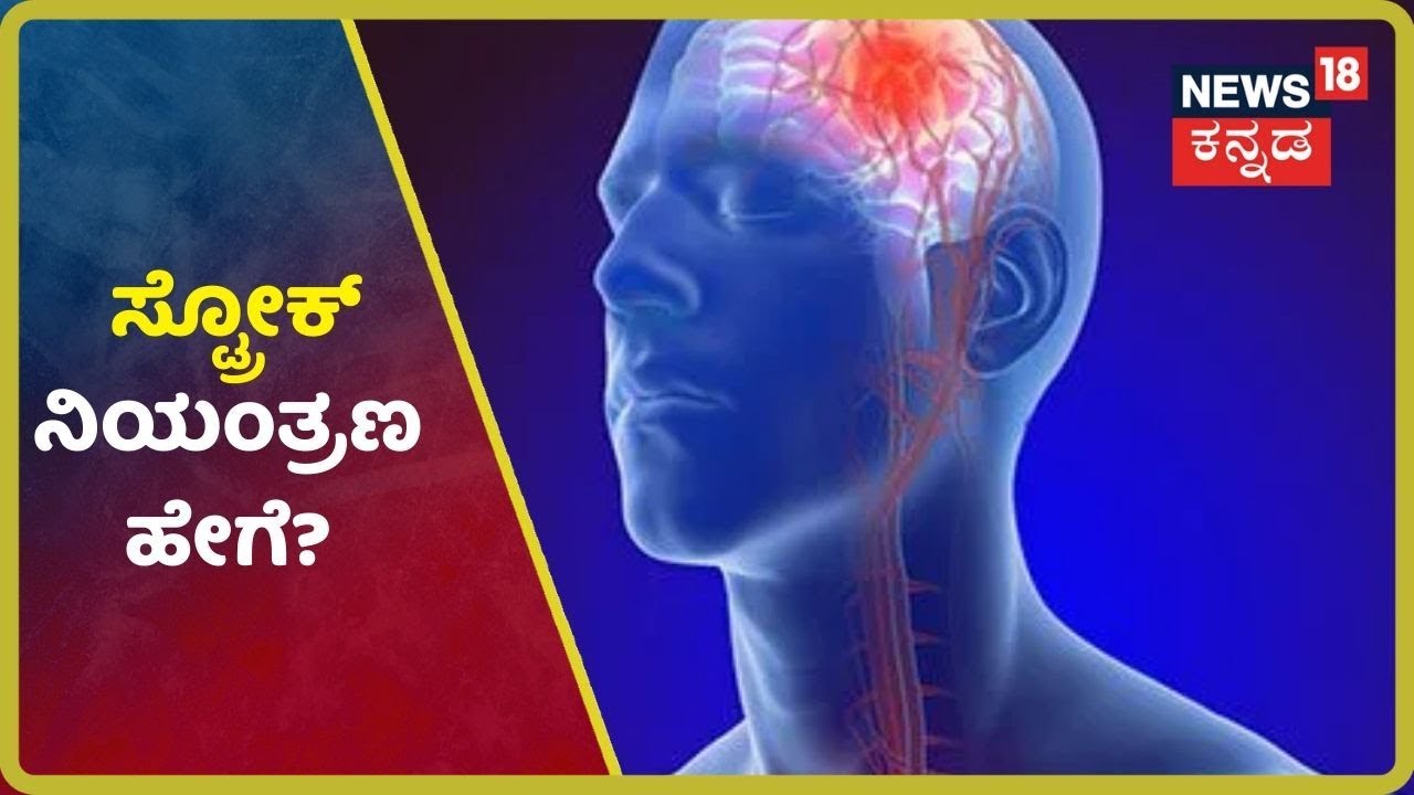 Stroke ಸಮಸ್ಯೆ ನಿಮ್ಮನ್ನು ಕಾಡುತ್ತಿದೀಯಾ? Manipal ಆಸ್ಪತ್ರೆಯಲ್ಲಿದೆ ಪರಿಹಾರ