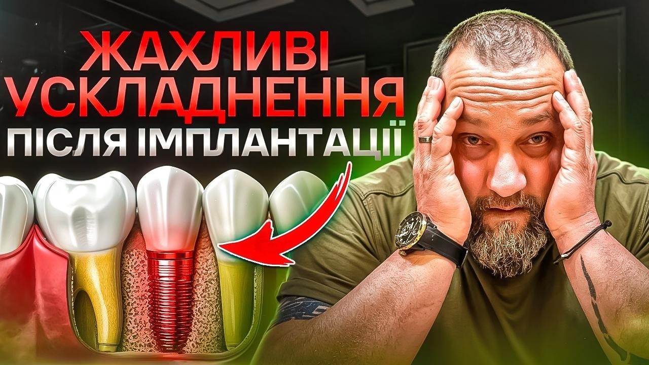 🇺🇦 Какие могут быть осложнения после имплантации зубов