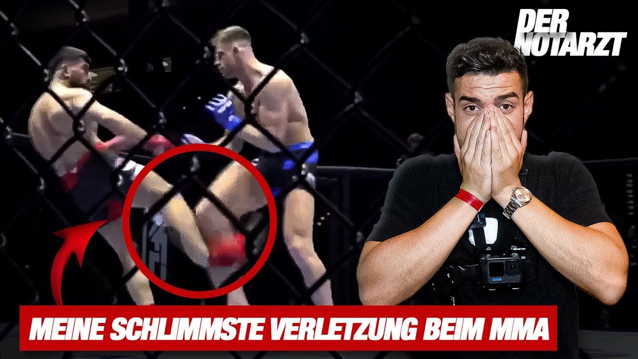 UNTERSCHENKELBRUCH im MMA & So bereite ich mich als Arzt auf RCS 5 vor!