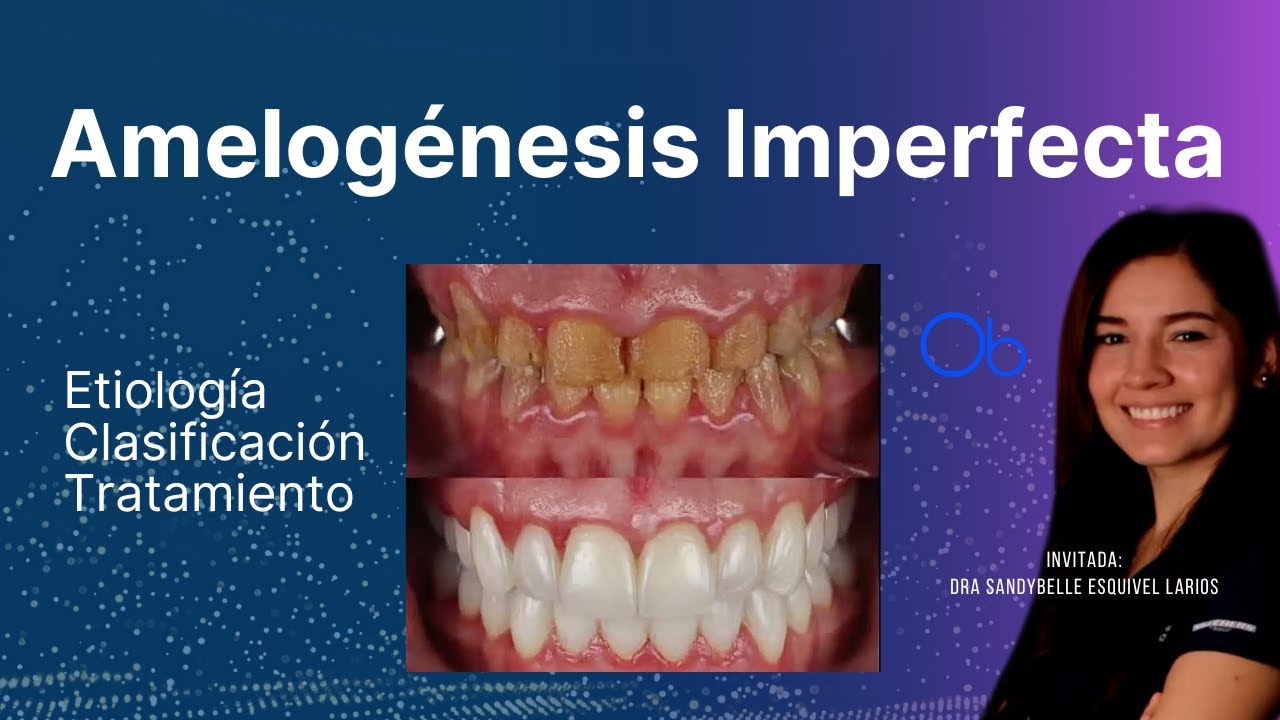 Amelogénesis Imperfecta 🦷 con Dra Sandybelle Esquivel Larios
