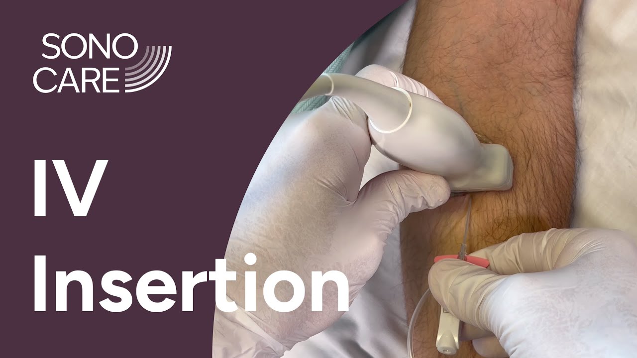 Peripheral IV/Arterial Line Insertion