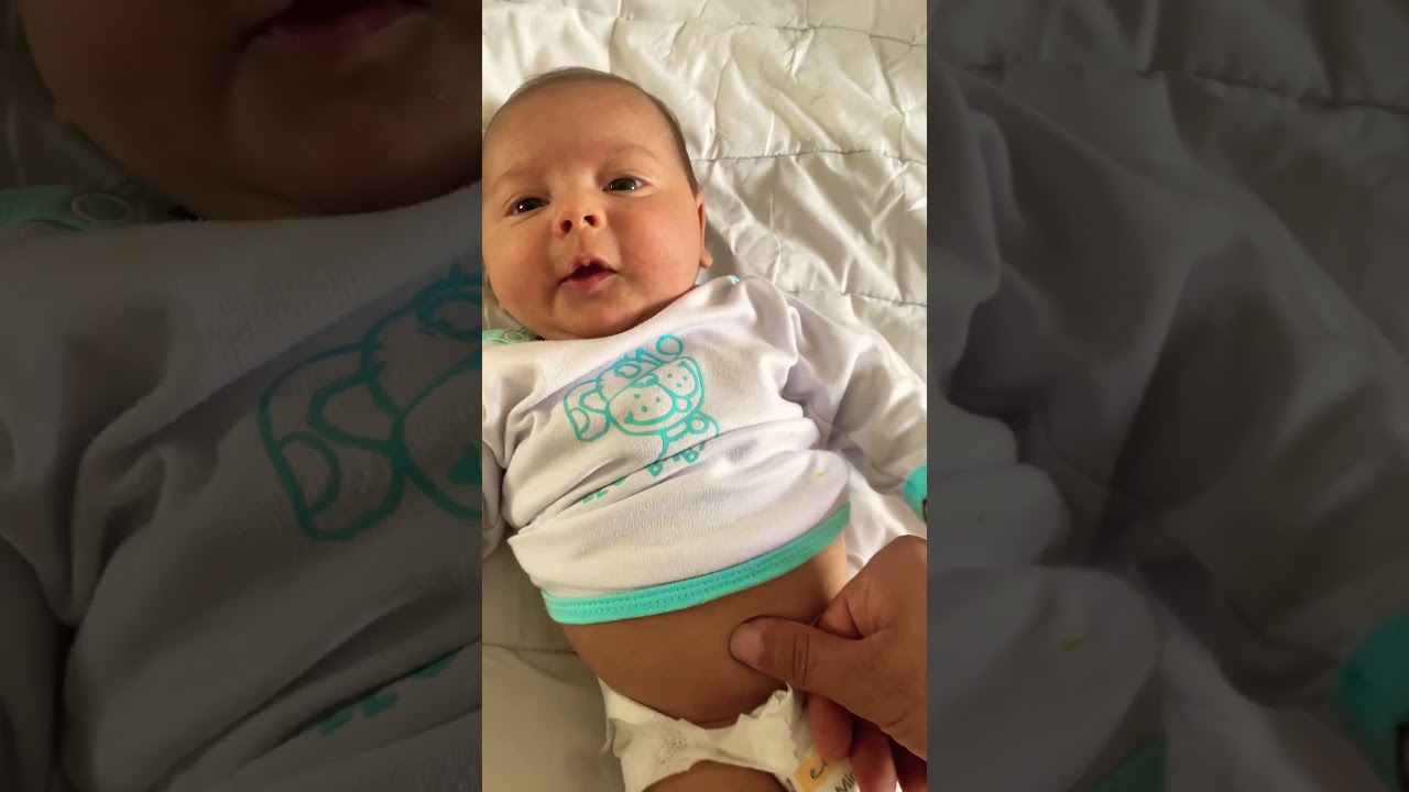 Why is my baby's navel protruding?#navel#shorts #shortvideo