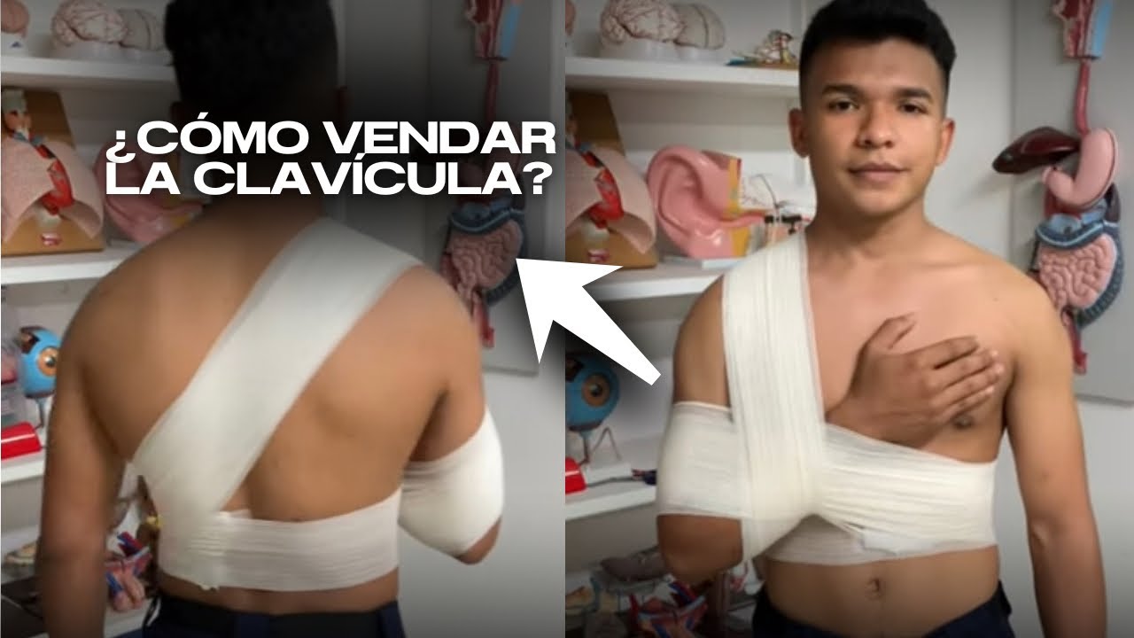 VENDAJE DE CLAVÍCULA FRACTURADA