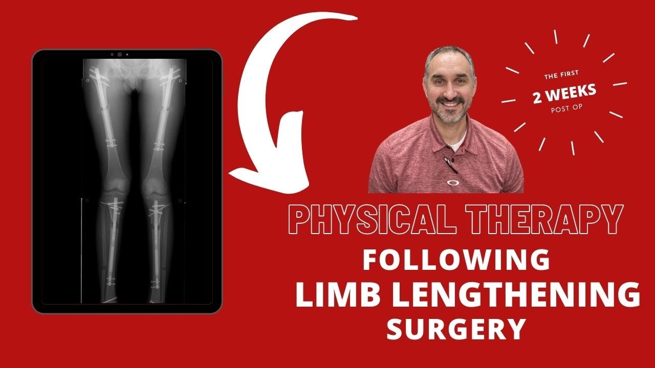 What should I do after Limb Lengthening Surgery???