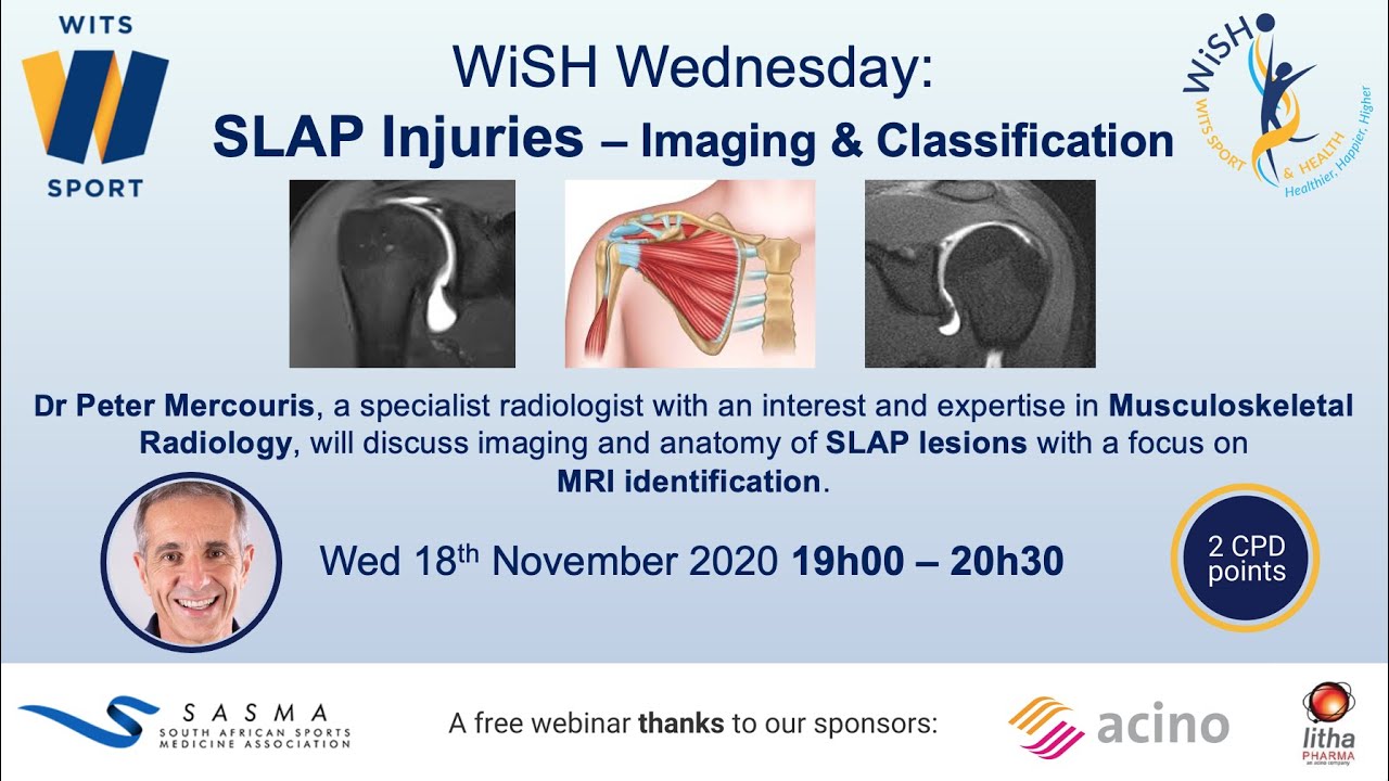 WiSH Webinar 