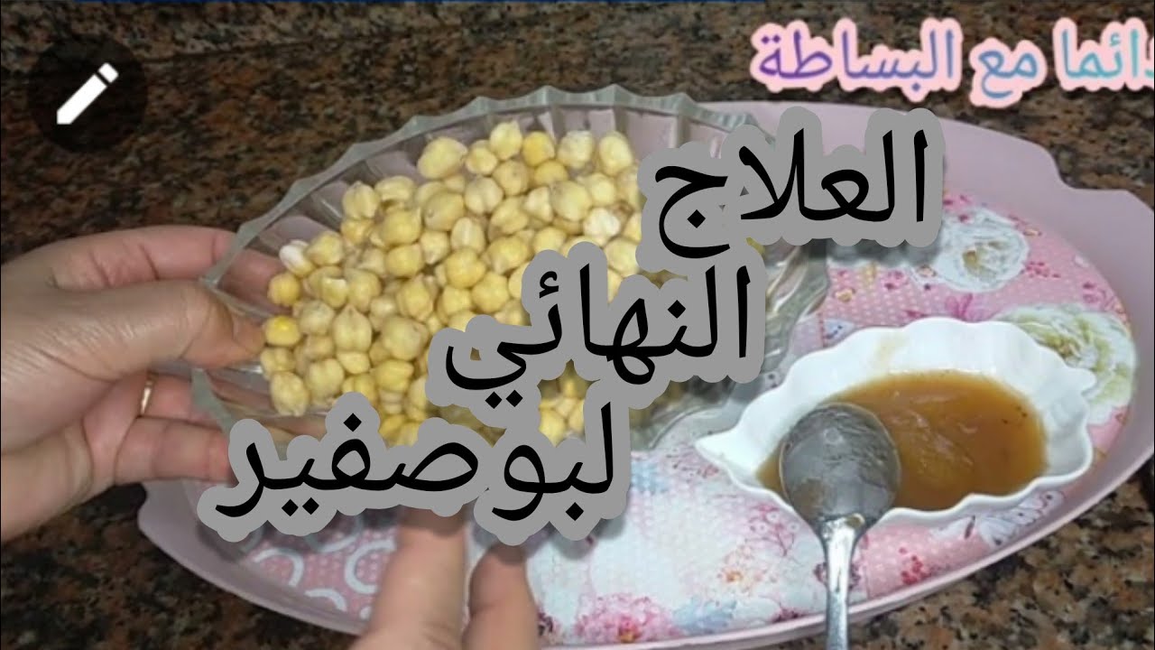 كيفاش عالجت بنتي من بوصفير بوصفات طبيعية و متوفرة  عندنا (دائما مع البساطة)