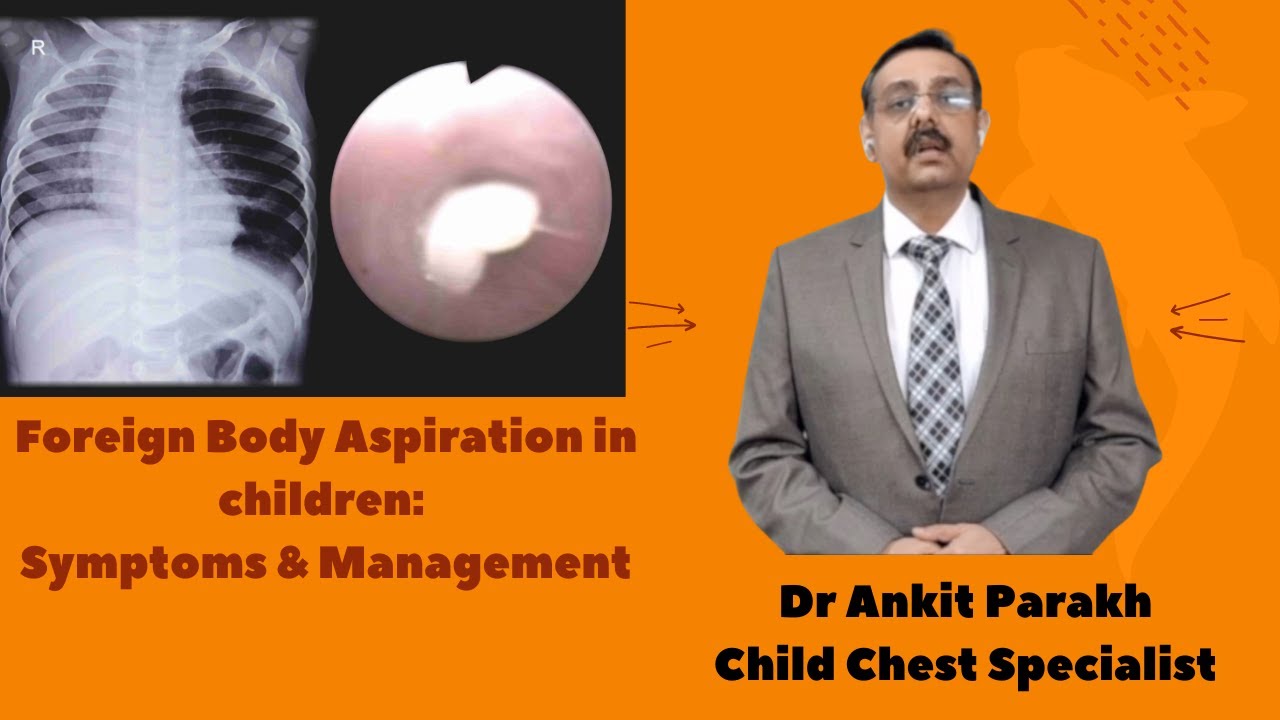Foreign Body Aspiration in Children: Symptoms & Management I DR Ankit Parakh, Child Pulmonologist