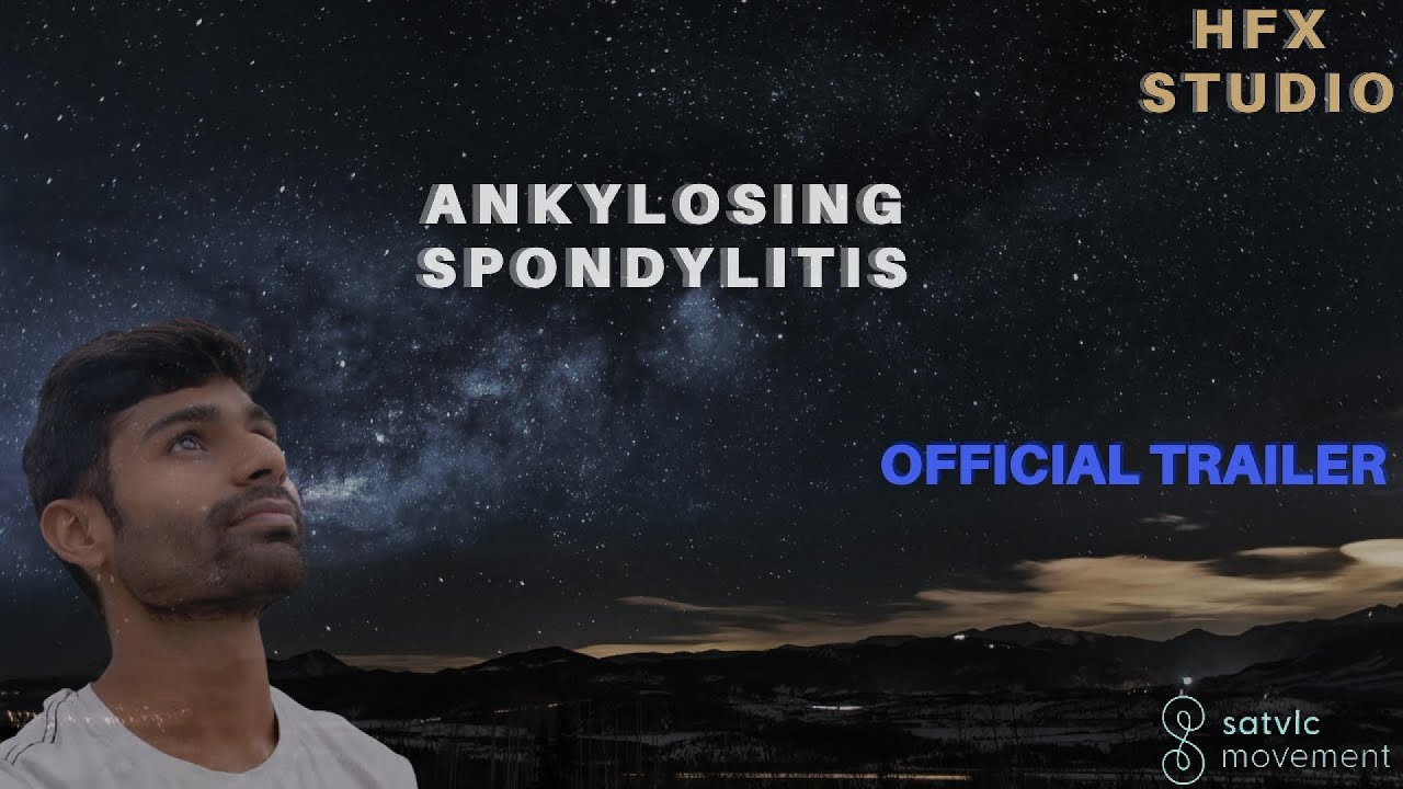  Ankylosing spondilities  A RARE disease