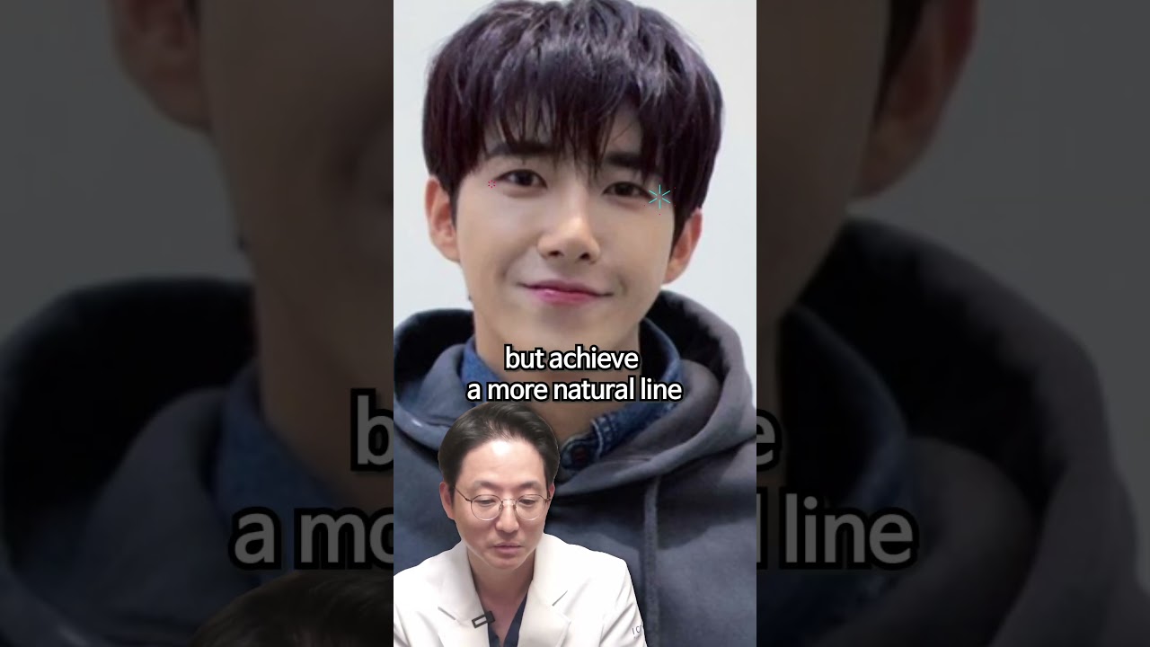 KPOP Kwanghee Have plastic surgery? 