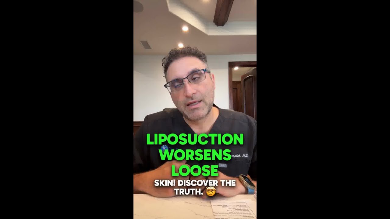Lipo Myth That Makes Skin Worse | Beverly Hills