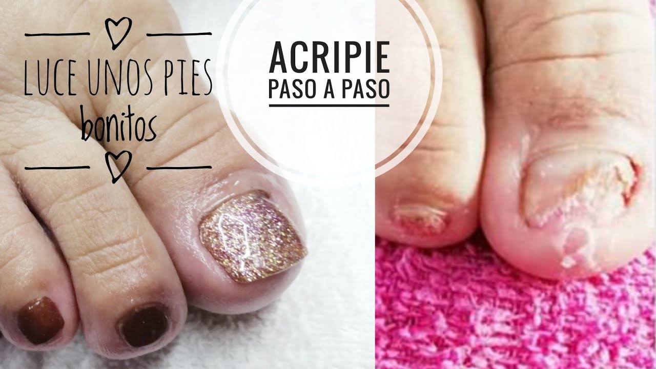 Como hacer un acripie  paso a paso super fácil