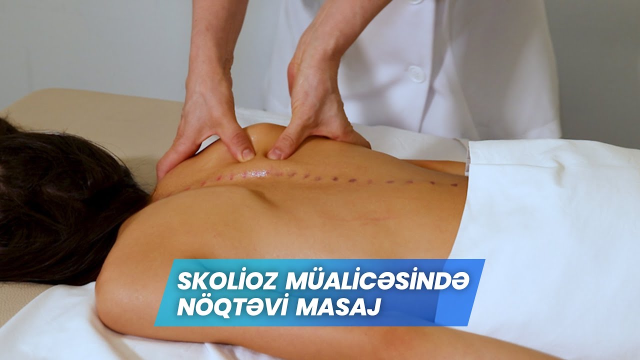 Skolioz müalicəsində nöqtəvi masajın əhəmiyyəti