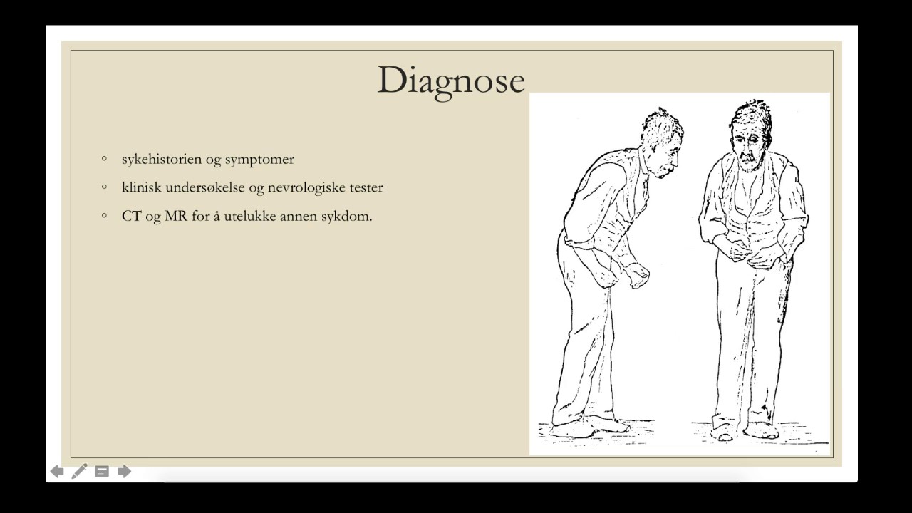 Parkinson Sykdom