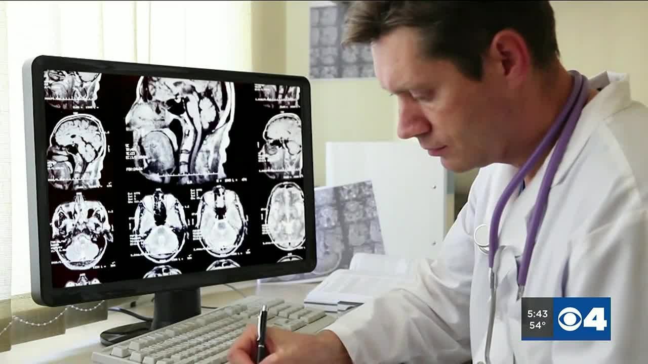 Research suggests link between Alzheimer&rsquo;s and Down syndrome