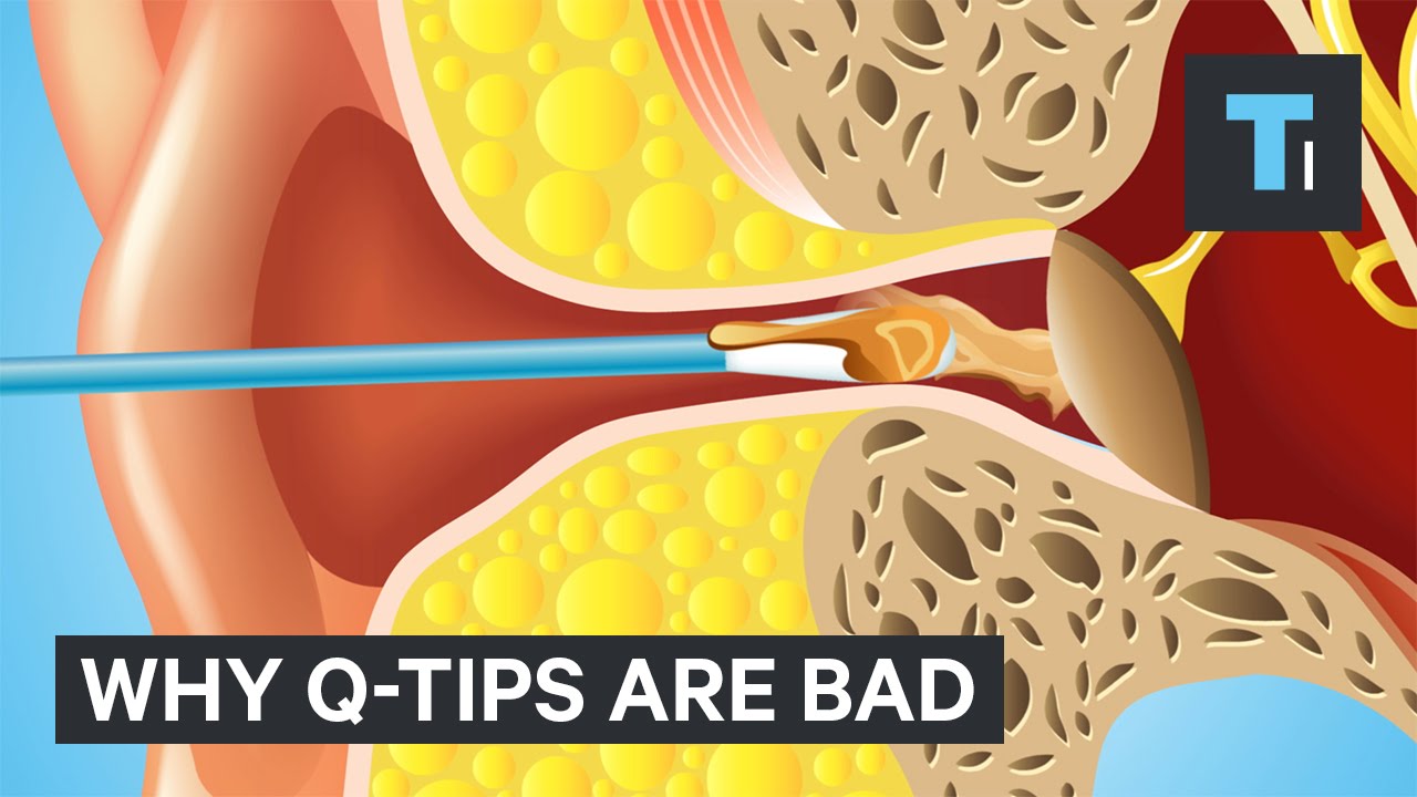 Why Q-Tips are bad