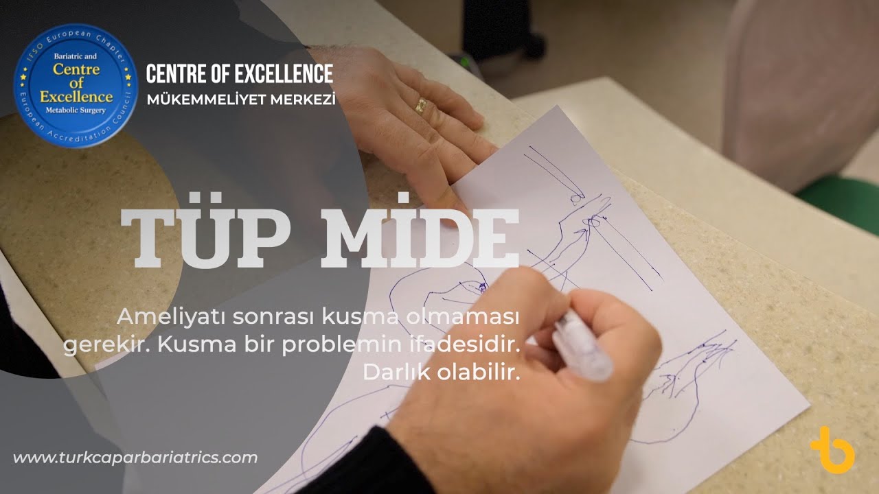 Tüp mide ameliyatı sonrası kusma olmaması gerekir. Kusma bir problemin ifadesidir. Darlık olabilir.