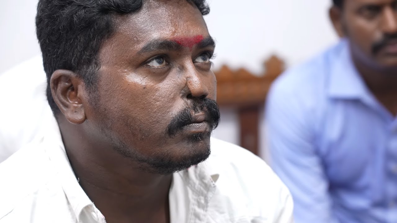 Man's Nose Burnt off in Fire - Plan for Forehead Flap Technique -  Reconstruction