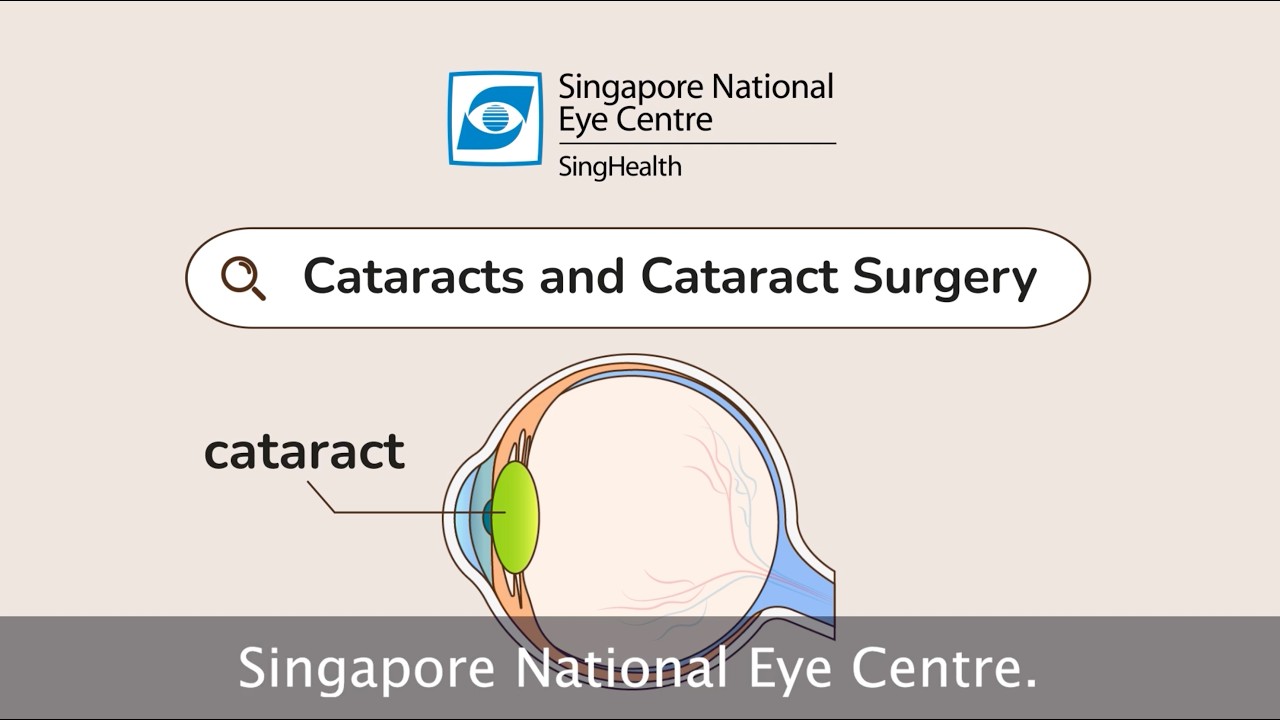 What is Cataract?