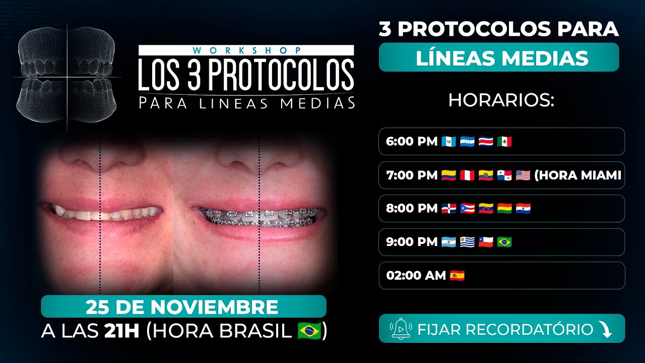 Live: Los 3 Protocolos para Líneas Medias