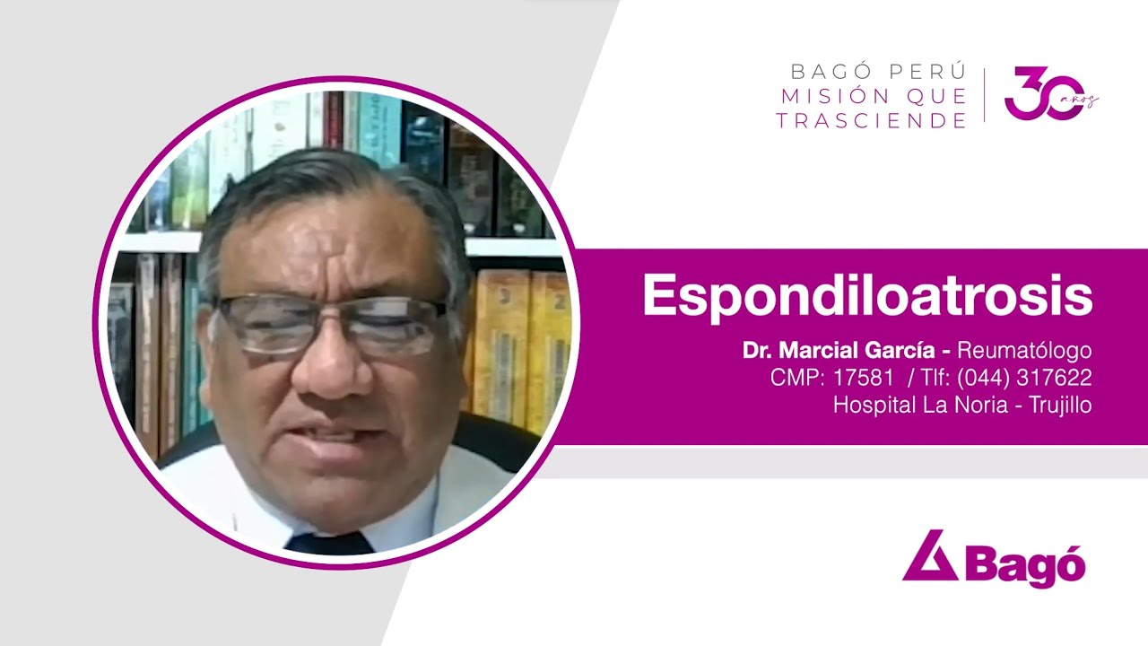 LA CIRUGÍA PARA CORREGIR LA ESPONDILOARTROSIS NO ES MUY FRECUENTE