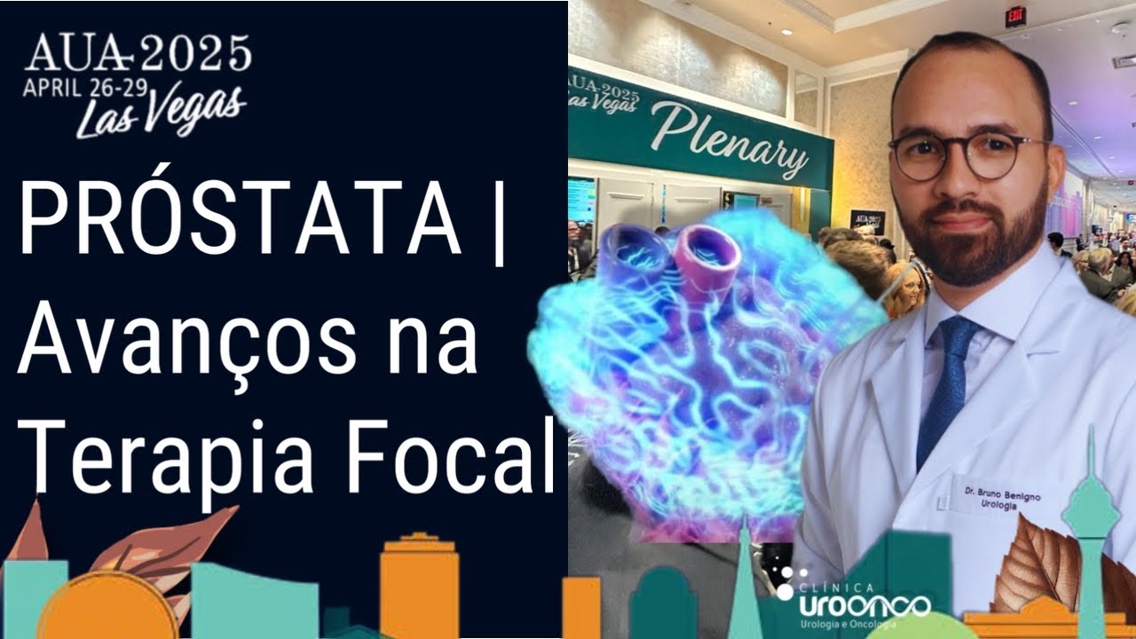 AUA 25 | PRÓSTATA | TERAPIA FOCAL | HIFU, ELETROPORAÇÃO E CRIOTERAPIA