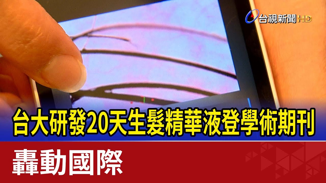 台大研發20天生髮精華液登學術期刊 轟動國際