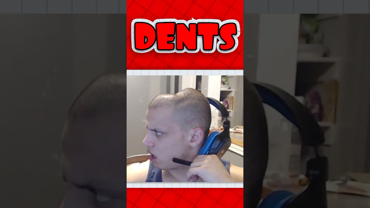 Is Headphone Dent Real?