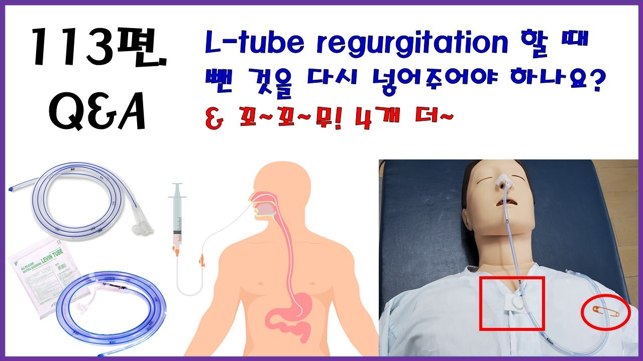 113. Q&A [L-tube Regurgitation 할 때, 뺀 것을 다시 넣어주어야 하나요??]