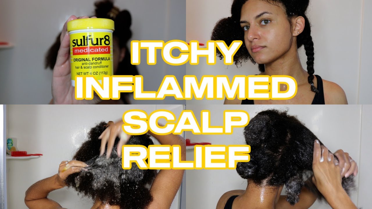 SULFUR 8 & WATER SAVED MY ITCHY SCALP! | Seborrheic Dermatitis Relief + Wash Day Routine (ASMR)