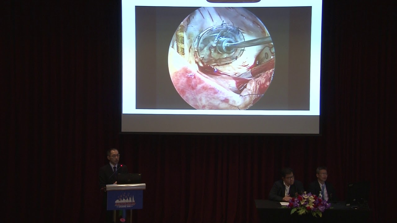 ASCVTS 2020 VIDEO SESSION