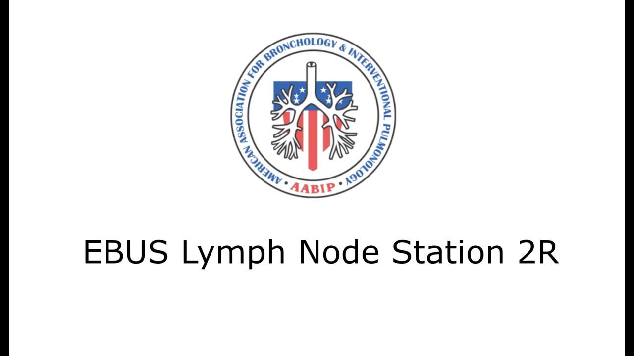 EBUS Lymph Node Station 2R