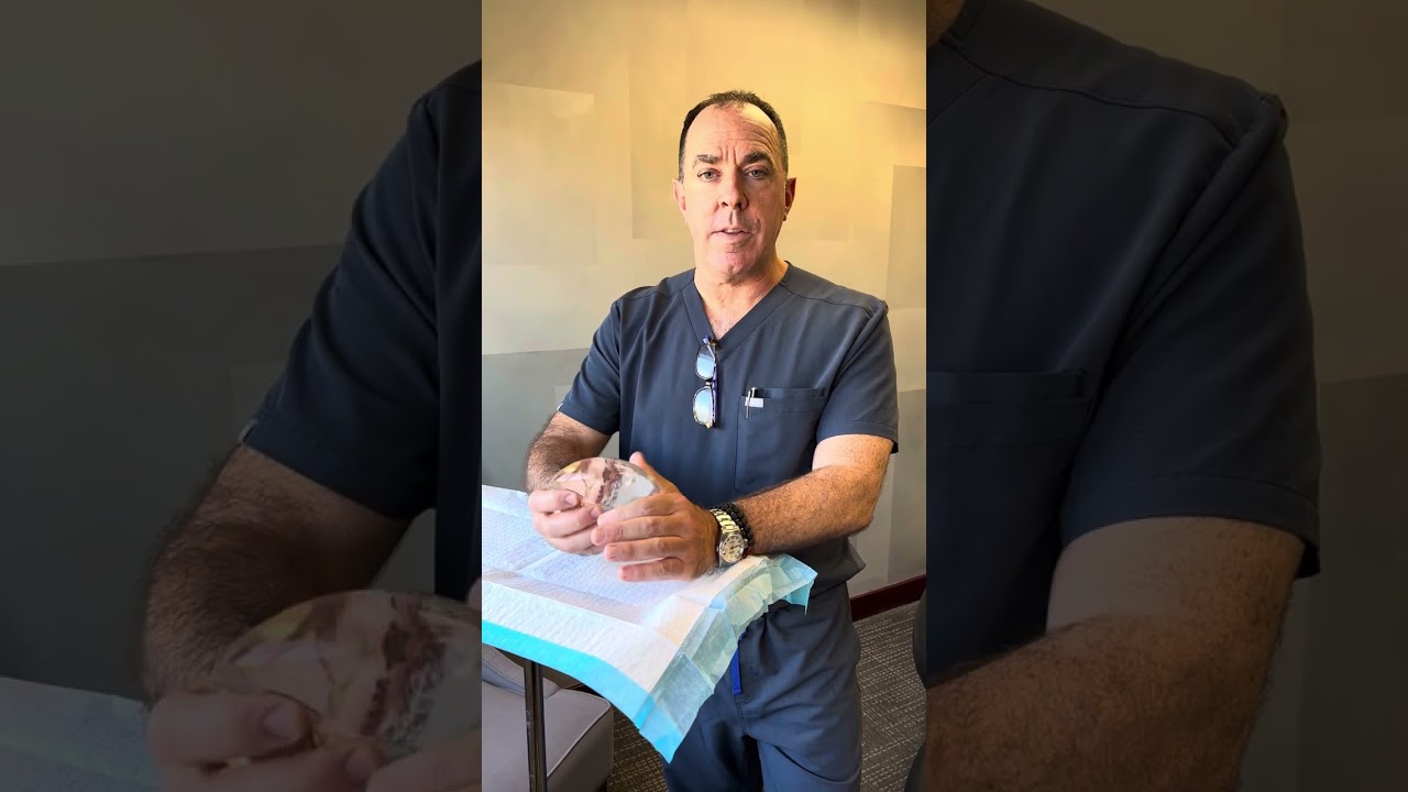 Board Certified Plastic Surgeon Sean Doherty reviews maintenance for breast implants