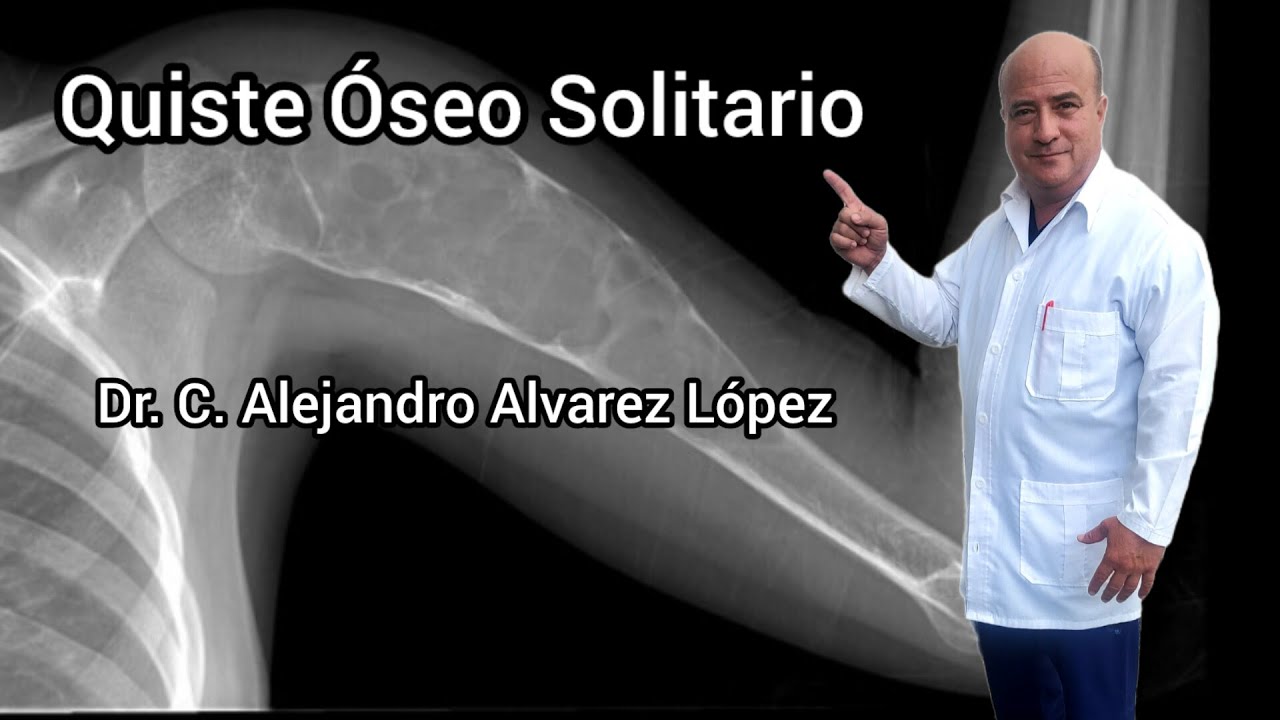 Quiste óseo solitario