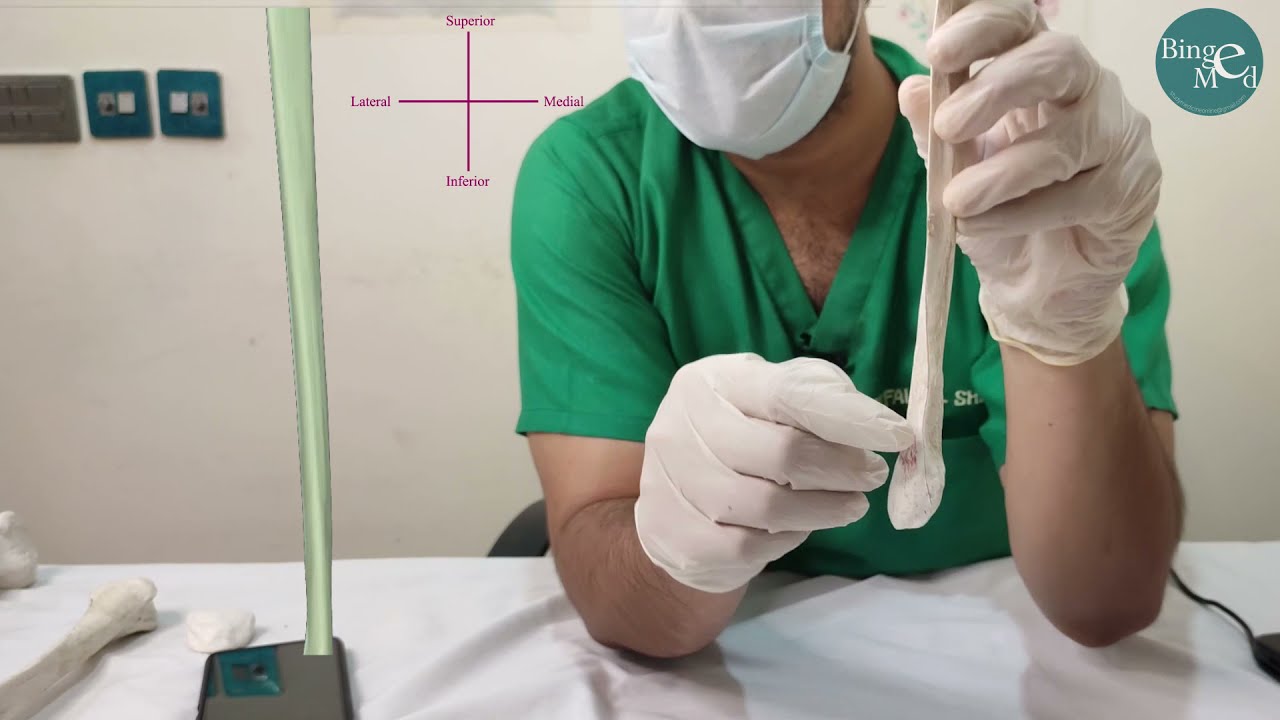 Fibula-Side determination