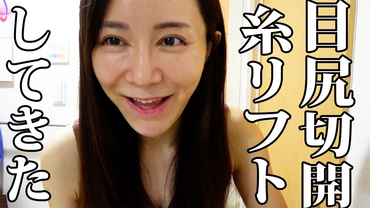 【感動レベル】垂れ目尻切開と糸リフトして帰宅後、こんな感じ。