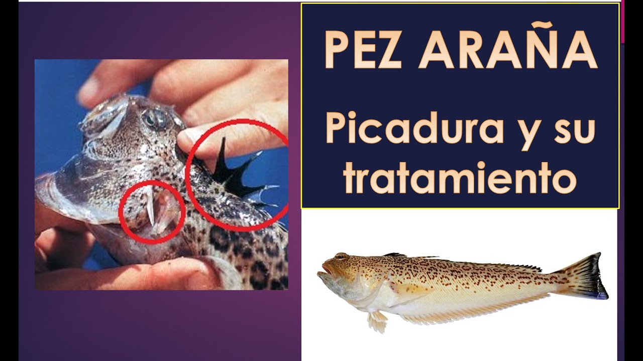 PICADURA DEL PEZ ARAÑA