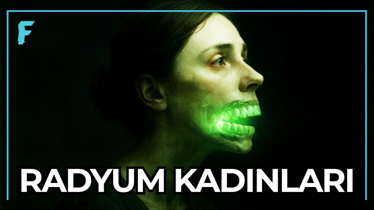 Tarihin En Karanlık Olayı - Çeneleri Eriyene Kadar Çalıştılar | Belgesel