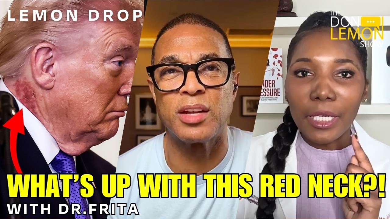 LEMON DROP | What Is Donald Trump's Neck Rash?!