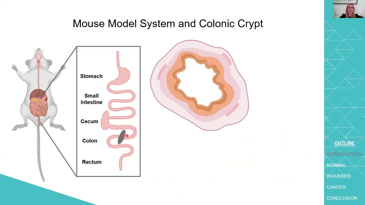 Amber Habowski Biomedical Sciences PhD Defense 2020