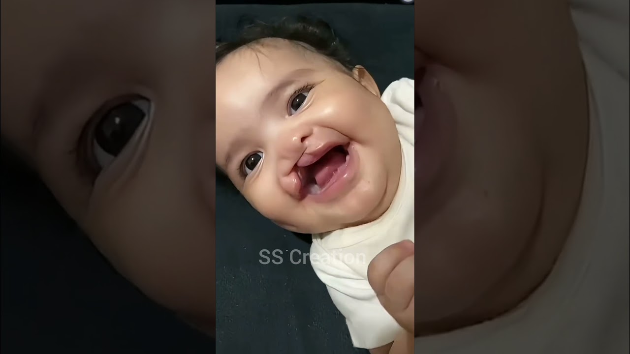 Disable Cute Baby❤️ #shortsvideo#disabled#shorts#viralvideo
