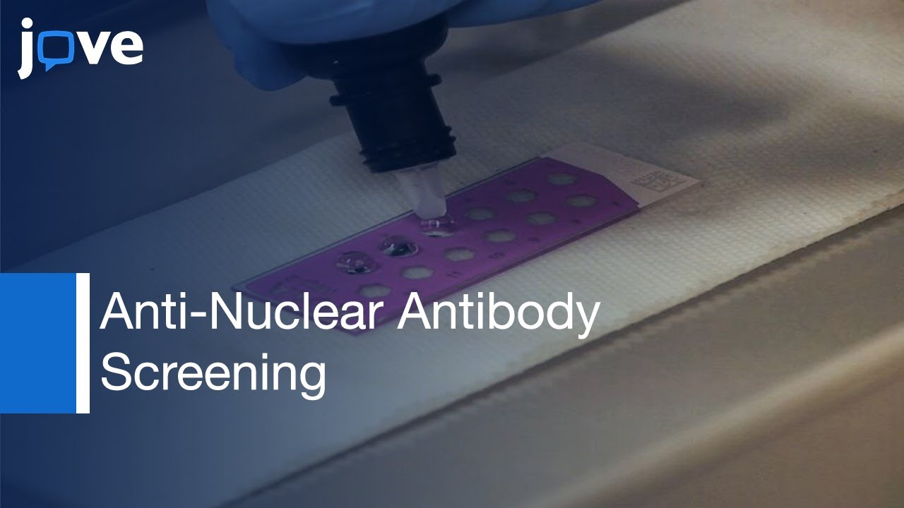 Anti-Nuclear Antibody Screening Using HEp-2 Cells