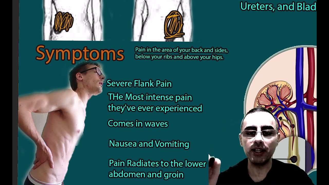 Renal Colic: Symptoms, causes and treatment