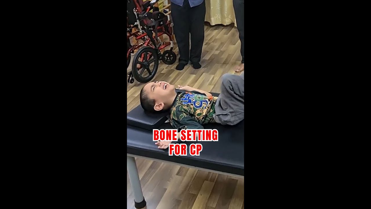 Bone Setting For CP