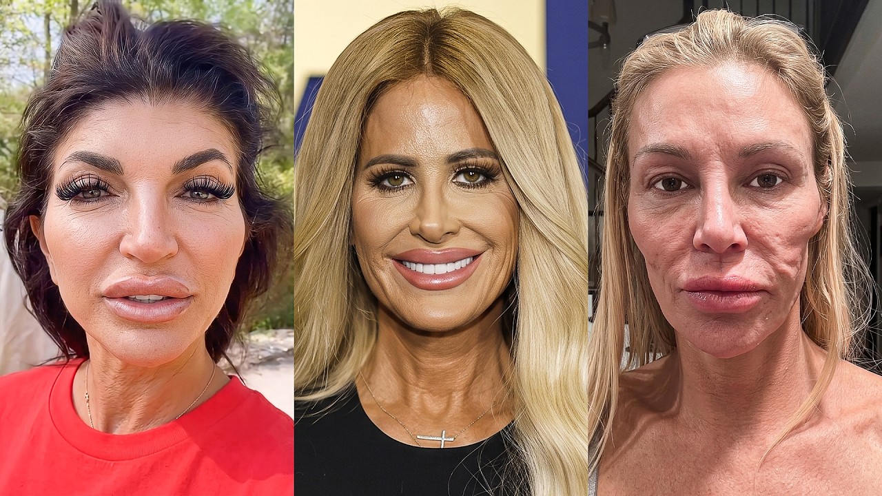 20 Real Housewives Facelifts Gone Wrong | Before & After 2026