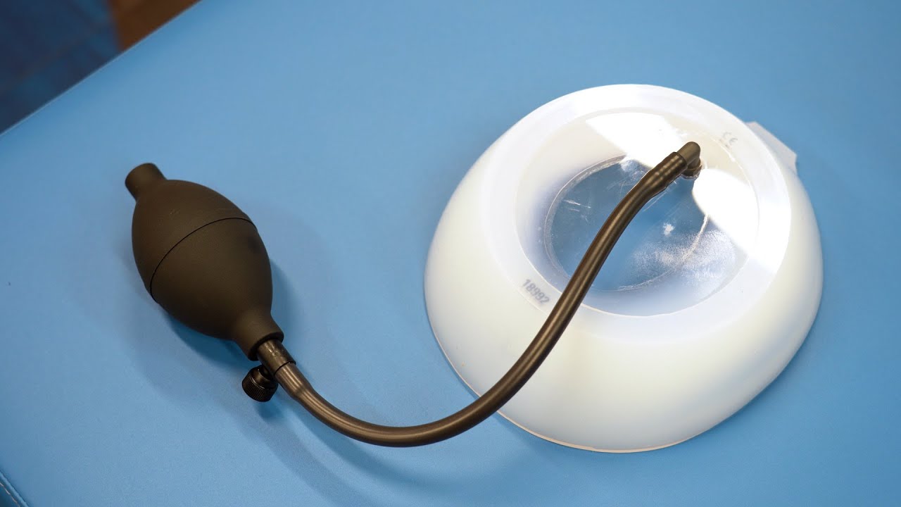 Vacuum Bell - Non Surgical Correction of Pectus Excavatum