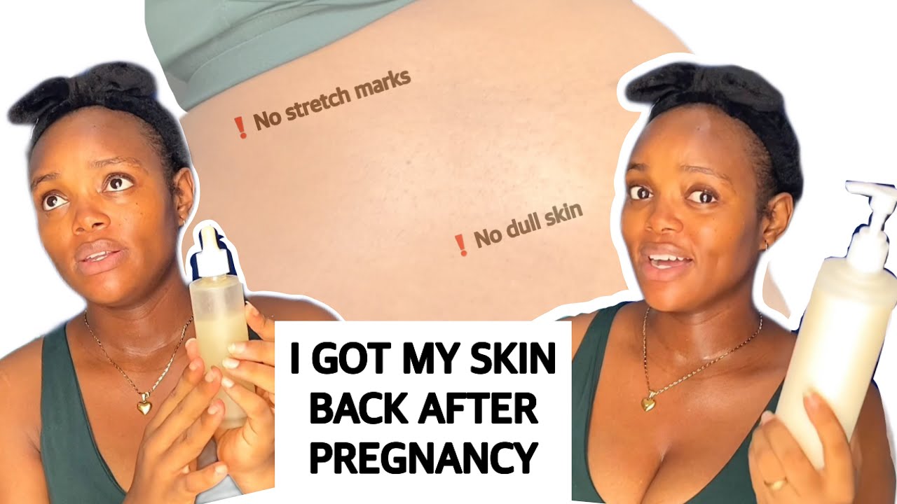 My Preggy skincare Tips and routine- no stretch marks no dull skin