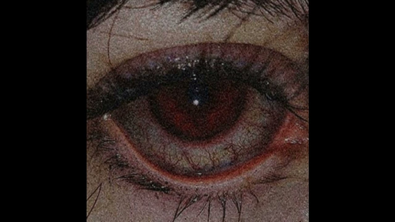 [SOLD] POUYA + GHOSTEMANE TYPE BEAT “BLOODSHOT” [PROD. DEAD RISE]