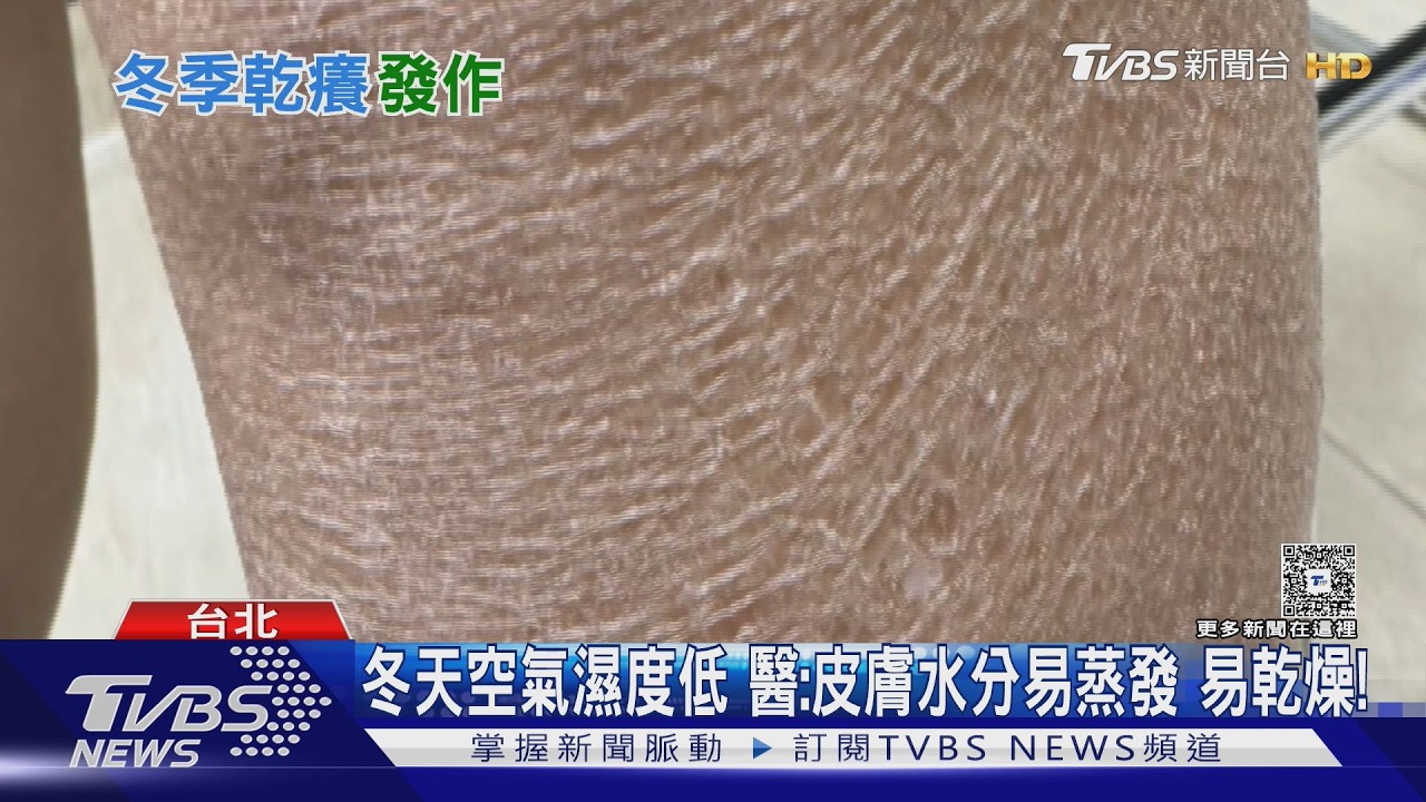 天冷乾燥皮膚狂癢? 醫揭冬季癢.冬季濕疹　好發部位與3招止癢!｜十點不一樣20260303 @TVBSNEWS02