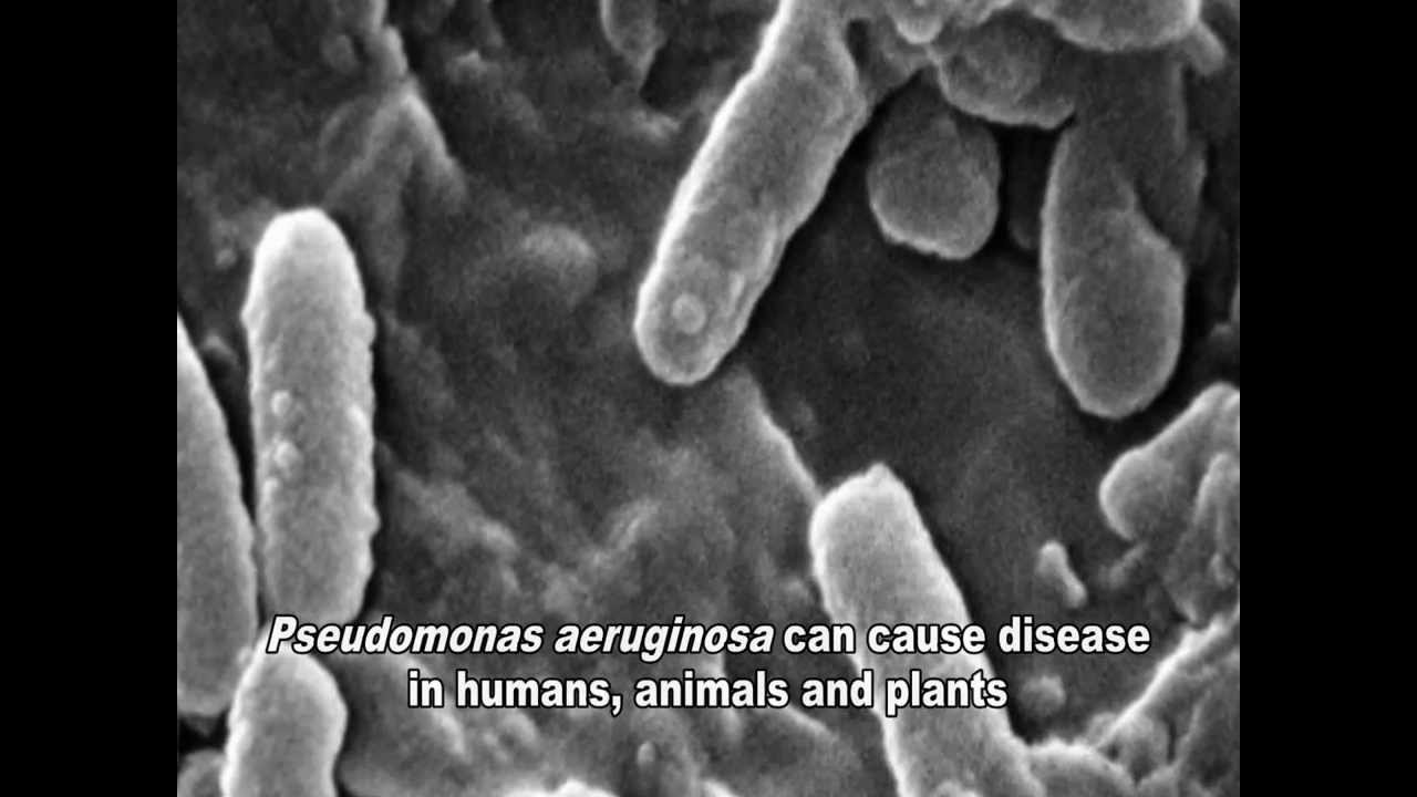 Pseudomonas aeruginosa Infections